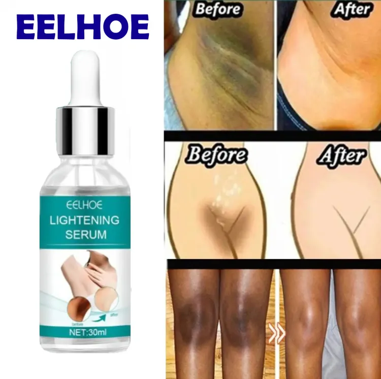 EELHOE Makes Brighter To Your Body And Posture Without Any Side Effect - Image 2